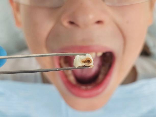 Best Pediatric Emergency Dentist in Rogersville, MO